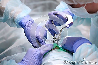 Removal of caries under General anesthesia in a child. The hands of a dentist in gloves.Copy of the space Stock Photo