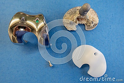 Removed implants of a knee prosthesis Stock Photo