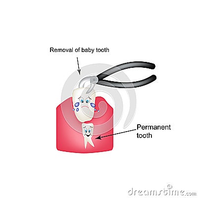 Removing baby teeth ticks. Children cartoon style. Infographics. Vector illustration on isolated background Vector Illustration