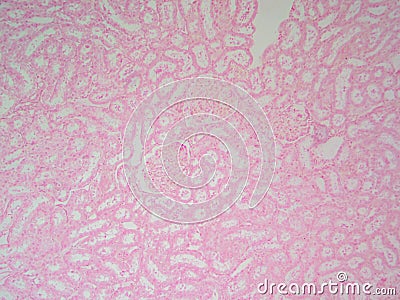 Renal Anatomy Closeup: Kidney Cortex with Tubules and Glomeruli at 100x Stock Photo