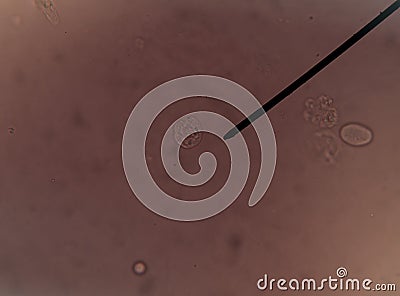 Renal epithelial cells fine with microscope. Stock Photo