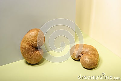 Renal system disease. Urogenital syndrome Stock Photo