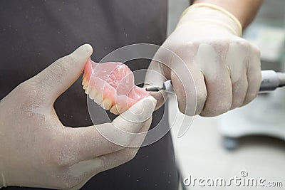 Repair of the upper jaw prosthesis insertion Stock Photo