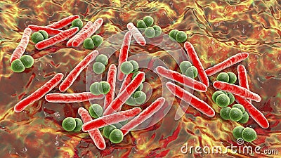 Respiratory pathogens, bacteria Mycobacterium tuberculosis and Streptococcus pneumoniae Cartoon Illustration