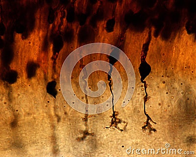 Retina. Golgi method. Bipolar cells Stock Photo