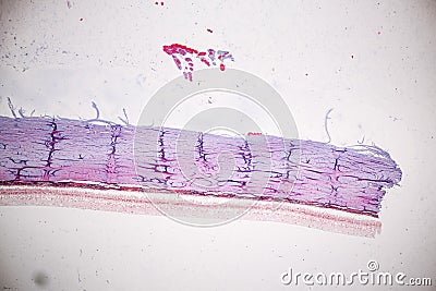 Retina human under microscope. Stock Photo