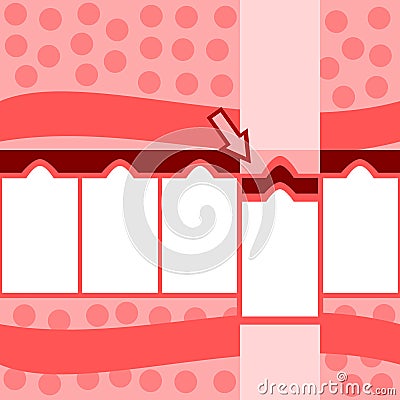 Retro stylized red pink white five steps info graphic Vector Illustration