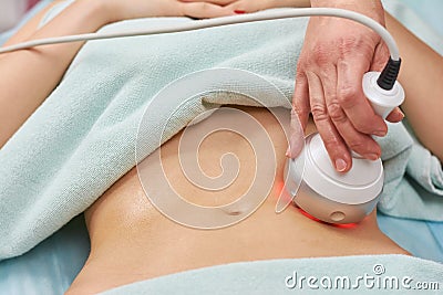 Rf skin tightening, belly. Stock Photo