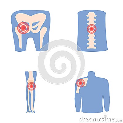 Rheumatism icons set cartoon vector. Human joint with pain ring Vector Illustration