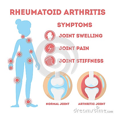 Rheumatism infographic. Bone disease on foot, hand Vector Illustration