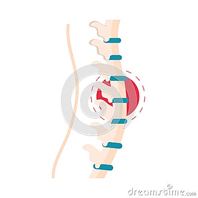 rheumatism vertebral column Vector Illustration
