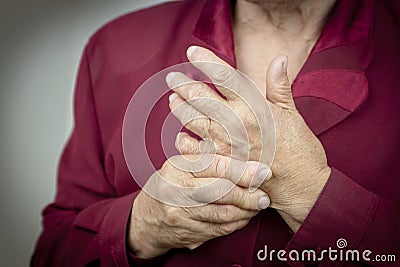 Rheumatoid arthritis hands Stock Photo