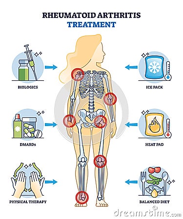 Rheumatoid arthritis treatment and health therapy methods outline diagram Vector Illustration