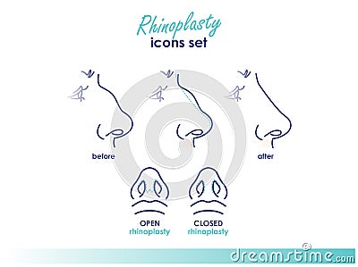 Rhinoplasty. Open and closed rhinoplasty. Side and bottom view. Plastic surgery nose. Medical and beauty line illustration Cartoon Illustration