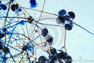 Rhizopus bread mold under the microscope Stock Photo