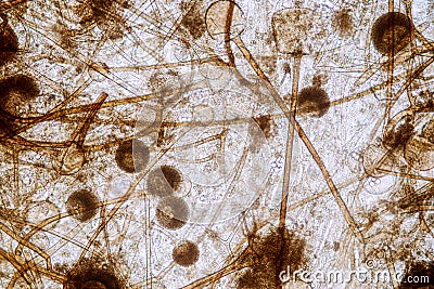 Rhizopus is a genus of common saprophytic fungi on Slide under the microscope for education. Stock Photo