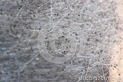 Rhizopus (bread mold) under the microscope. Stock Photo