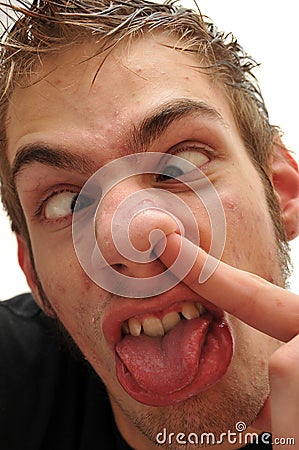 Ridiculous man picking his nose with crossed eyes Stock Photo