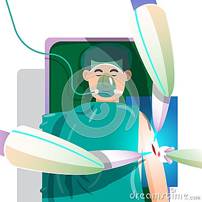 A Robotic Arm Performs Surgery On A Patient. Small Incision Robotic