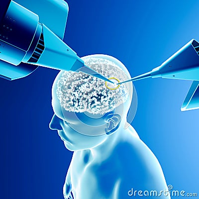 Robotic brain operation, neuron intervention, new technology, artificial intelligence. Link sensors Stock Photo