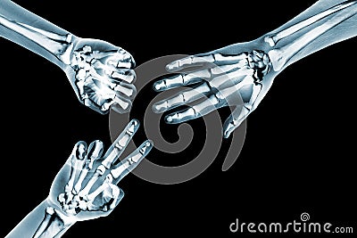Rock paper scissors game with x ray hands Stock Photo