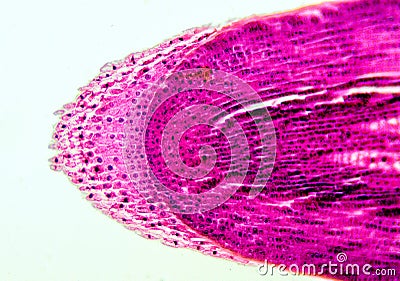 Root apex - microscopic view Stock Photo