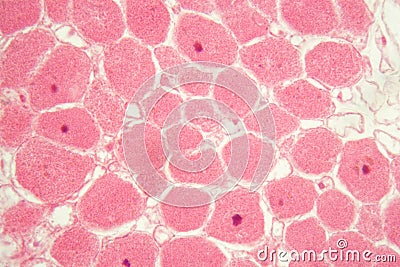 Root bacteria nodules under the microscope. Stock Photo