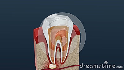 Root Canal Treatment Process. Stock Footage - Video of operation, periodontal: 180601050 Root Canal Treatment Process. Stock Footage - Video of operation, periodontal: 180601050