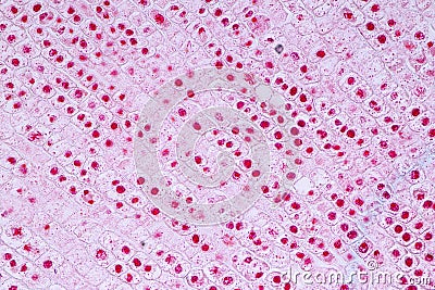 Mitosis cell in the Root tip of Onion under a microscope. Stock Photo
