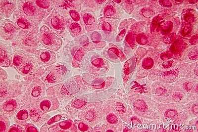 Root tip of Onion and Mitosis cell in the Root tip of Onion under a microscope. Stock Photo