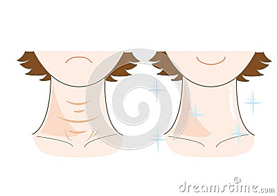 Rough skin of neck - Before and after Vector Illustration