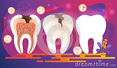 Row of Teeth with Dental Problems. Cross Section. Vector Illustration