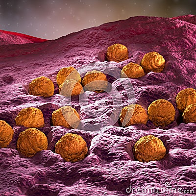 Rubella - German measles Stock Photo