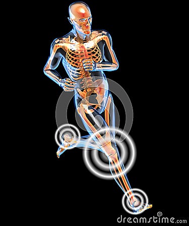Running man seen by x-raywith pain in the legs Stock Photo