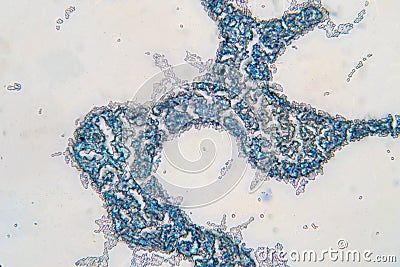 Saccharomyces cerevisiae yeast budding cell under microscope Stock Photo