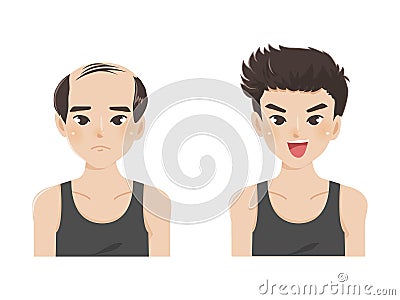 Sad bald man and a happy handsome man with a beautiful long hair Vector Illustration