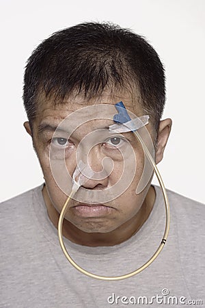 Sad Chinese man with nasogastric tube portrait Stock Photo