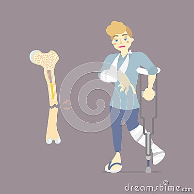 Sad patient with cast on broken leg and arm bone holding crutch, walking aid, internal organs body part orthopedic health care Vector Illustration