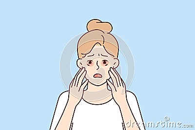 Sad woman with dry reddened eyes due to irritation or allergic reaction caused by food Vector Illustration