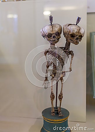 Saint Petersburg. Russia. Siamese twins. an exhibit in the museum. Collection of Emperor Peter the Great Editorial Stock Photo