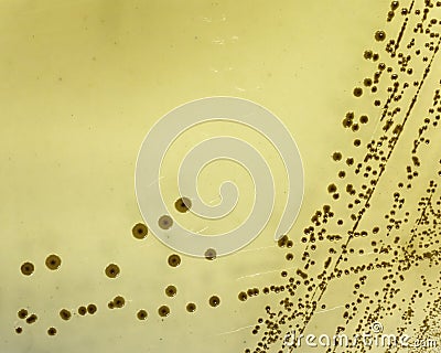 Salmonella growing on bismuth sulphite agar Stock Photo