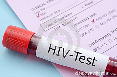 Sample blood collection tube with HIV test. Stock Photo