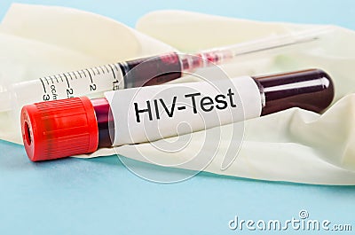 Sample blood for screening test for HIV test. Stock Photo