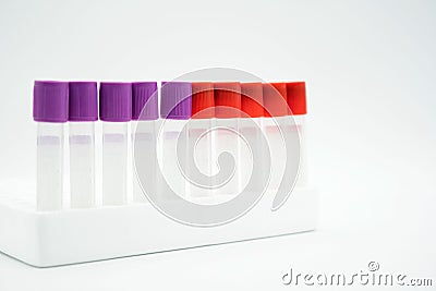 Sample blood tube from patient on white background . copy space , space for text and image . Medical equipment Stock Photo