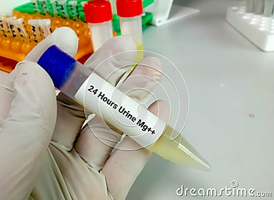 Sample for the measurement of the concentration of 24 hours urine magnesium. Stock Photo