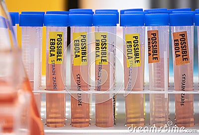 Sample vials of possible Ebola patients infected with new Zaire strain of Ebola Stock Photo