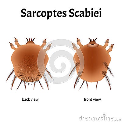 Sarcoptes scabiei. scabies. Sexually transmitted disease. Infographics. illustration on isolated background. Vector Illustration