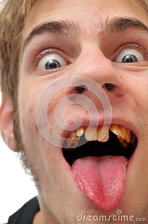 Say AH - cavity search Stock Photo