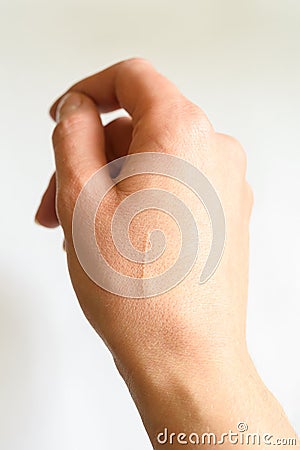 a scar on the hand - a scratch Stock Photo