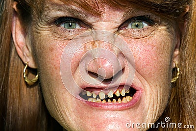 ugly sandals for men